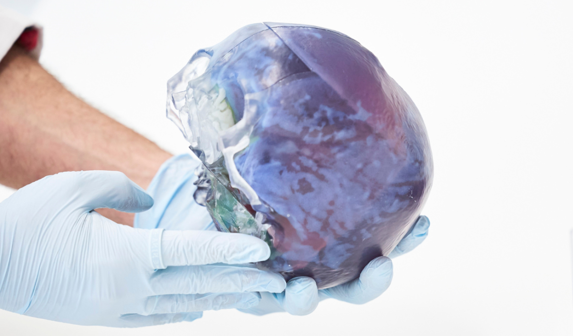 A person wearing blue clinical gloves holds a plastic 3D printed skull in their hands.
